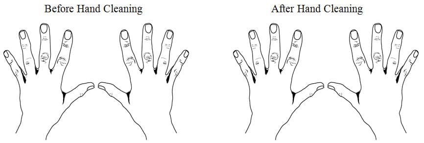 Before and After Hand Cleaning